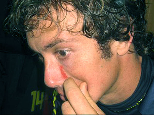 Lugano mostra a unhada que levou no cl�ssico turco